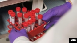 Hiromitsu Nakauchi's research centers on creating animal embryos that contain human cells. If the experiments are successful, researchers hope to someday grow human-sized organs in animals like pigs and sheep.(AFP Photo/SAUL LOEB)