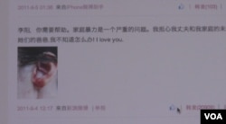 李金将自己被家暴后的瘀青照片贴到网上（VOA视频截图）