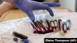 In this photo taken March 21, 2017, a nurse reaches for blood samples taken from a patient receiving a kind of immunotherapy known as CAR-T cell therapy at the Fred Hutchinson Cancer Research Center in Seattle.