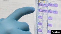 FILE - A medical researcher uses a monitor that shows the results of blood tests for various diseases, including Zika, at the Gorgas Memorial laboratory in Panama City, Feb. 4, 2016. 