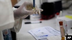 지난 2일 콰테말라 시 산부인과 병동에서 지카 바이러스 감염자로 판명된 임산부의 혈액을 검사하고 있다.