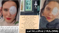 استوری‌های اینستاگرام راحله امیری