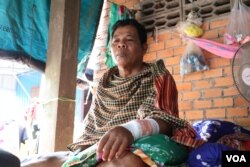 លោក ស៊ិន បូណា អាយុ៥៩ឆ្នាំ អតីតចៅសង្កាត់កោះដាច់របស់គណបក្សសង្រ្គោះជាតិ ក្នុងខណ្ឌជ្រោយចង្វារ រាជធានីភ្នំពេញ ដែលត្រូវបានលបវាយដោយដំបងដែក រហូតដល់បាក់ខ្នងដៃ កាលពីថ្ងៃទី២៥ ខែកញ្ញា ឆ្នាំ២០១៩។ (ស៊ុន ណារិន/VOA Khmer)