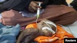 Zamzam Jamac, a Somali woman displaced by the worsening drought due to failed rain seasons, feeds her child Fatuma Botan, 1, through a nasogastric tube at the paediatric ward in the Banadir Hospital, in Mogadishu, Sept. 24, 2022. 