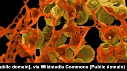 Uzorak "superbakterije" MRSA, otporne na većinu antibiotika 