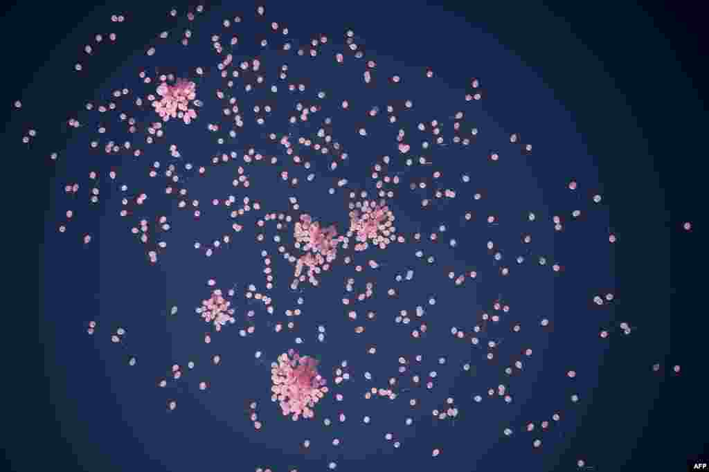 1.200 balon berwarna merah muda (pink) melayang di angkasa kota Sofia, Bulgaria dalam rangka kampanye anti kanker payudara. 