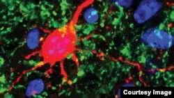 This enhanced image of a mouse brain shows fibers (green) that connect the thalamus, the midbrain’s switchboard for sensory information to neurons (red) in the auditory cortex. (Credit: Emily Petrus/Amal Isaiah)