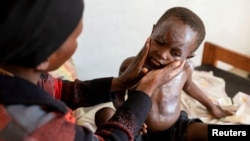 지난 8월 콩고 민주 공화국 북키부 주 무니기의 건강 센터에서 한 어린이가 Mpox 바이러스 치료를 받고 있다. (자료화면)