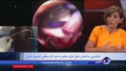 شناسایی سلول های تشکیل دهنده لایه بیرونی غضروف مفصلی انسان