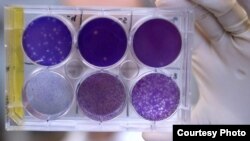A researcher at Washington University School of Medicine in Missouri holds a tray of Zika virus. Researchers have identified a human antibody that prevents Zika in pregnant mice. (Photo courtesy of Huy Mach)