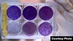 A researcher holds a tray of Zika virus growing in animal cells at Washington University School of Medicine in St. Louis, Missouri. Researchers have identified a human antibody that prevents, in pregnant mice, the fetus from becoming infected and the plac