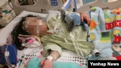 지난해 9월 용혈성요독증후군(HUS) 진단을 최은주 씨의 딸이 심정지로 인해 소아중환자격리실에서 에크모 시술을 받는 모습. (피해자 측 법률대리인 황다연 변호사 제공)