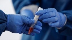 ການທົດສອບໃໝ່ທີ່ພັດທະນາຢູ່ມະ​ຫາ​ວິ​ທະ​ຍາ​ໄລ UCLA ຈະເປັນການປ່ຽນແປງເກມ ໃນການວິນິດໄສວັນນະໂລກ