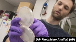 Research technician Henri Berger talks about live yeast cultures at New York Unversity Lab on April 25, 2017. The lab is one of 11 working to build redesigned yeast DNA from scratch. (AP Photo/Mary Altaffer)
