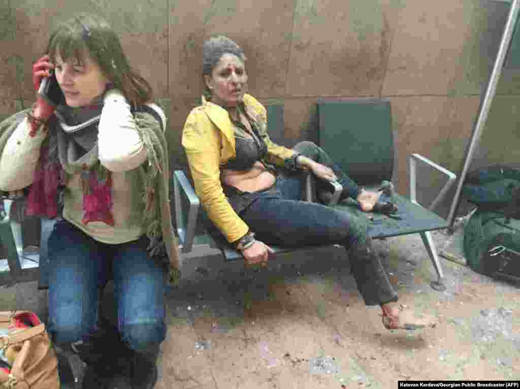 An injured woman looks on as another speaks on her mobile phone following twin blasts at Brussels airport in Zaventem, Belgium, March 22, 2016. Islamic State group (IS) millitants launched attacks at the city&#39;s airport and in a Metro train, killing more than 30 people and injuring more than 200 people.