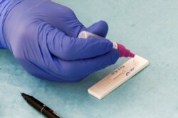 រូប​ឯកសារ៖ ឧបករណ៍​ធ្វើ​តេស្ត​រហ័ស​ (Rapid Test) នៅ​ប្រទេស​អ៊ីតាលី​ កាល​ពី​ឆ្នាំ​២០២០។