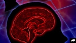 Patients may be more likely to survive a stroke if ambulance crews take them to a certified stroke facility, a new study finds.