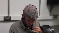 Device May Help Stroke Patients Move Again by 'Re-Wiring' Brain