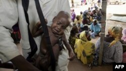 Un enfant souffrant de malnutrition est pesé dans un centre de Médecins sans frontières (MSF), à Dogo près de Zinder au Niger, le 24 août 2005.