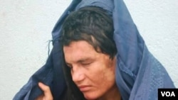 گل بشره باشنده ولایت غزنی اخیرآ در نتیجه خشونت های خانواد ه گی دو چشم خود را از دست داده است.