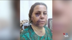 داستان سرکوب جمهوری اسلامی در جنبش مهسا؛ مادری با ساچمه‌هایی در سر و پدری ناپدید شده