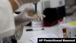 APTOPIX Guatemala Zika Virus