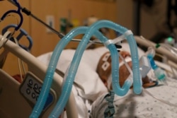 FILE - Ventilator tubes are attached to a COVID-19 patient at Providence Holy Cross Medical Center in the Mission Hills section of Los Angeles, Nov. 19, 2020.