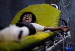 Anak Yaman Manea Abdul-Latif Marzouq (12 tahun) dirawat di rumah sakit akibat terluka dalam serangan udara koalisi pimpinan Arab Saudi (foto: dok).