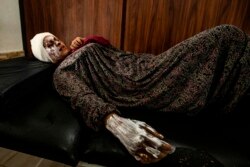Syrian patient Fatima al-Issa who was hit by shrapnel during Turkish bombardment of Ras al-Ayn, rests after receiving treatment at a hospital in Tal Tamr in Syria's northeastern Hasakeh province, Oct. 11, 2019.