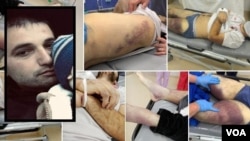 ოკუპირებულ ცხინვალში მოკლული ინალ ჯაბიევის ნაწამები ცხედარი 28.08.2020