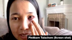 Mantakarn Seenin, A Thai woman shows her wounds on her face cause by brutally attacked while riding the BART train in San Francisco, CA. 