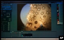 FILE - Living coral is shown under a microscope at the Hawaii Institute of Marine Biology on Coconut Island, Hawaii,Sept. 28, 2015.
