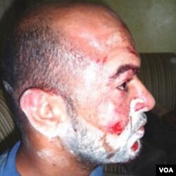 Sayed Abbas Sayed Mahdi, salah seorang korban yang tercatat oleh Bahrain Center for Human Rights sebagai salah seorang korban pemukulan oleh aparat keamanan setempat.