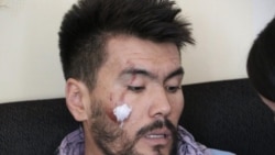 یکی دیگر از ژونالستانی که روز دوشنبه هنگام پوشش خبری اعتراضات زنان و دختران در کابل مورد لت و کوب طالبان قرار گرفت