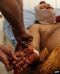 Iroq bo’ylab qonli xurujlar o’nlab odamni hayotdan olib ketdi