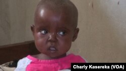 Un enfant malnutri à l'hôpital de référence de Minova, Nord-Kivu, RDC, 13 février 2018. (VOA/Charly Kasereka)