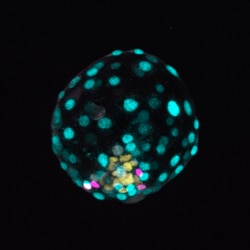 This image, provided by the Institute of Molecular Biology of the Austrian Academy of Sciences, shows a human “blastoid” created in a lab. (Photo by Alok Javali, Heidar Heidari and Theresa Sommer/Institute of Molecular Biology of the Austrian Academy of S