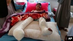 An injured child rests in a hospital a day after an airstrike in Saada, Yemen on Aug. 10, 2018.
