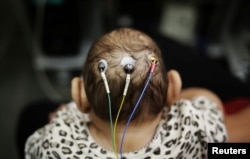 Five-month-old Laura undergoes a medical test at the University of Sao Paulo (USP) in Sao Paulo, Brazil, April 28, 2016.