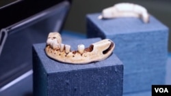 One museum exhibit shows many false teeth, including a set that belonged to America's first president, George Washington. (From VOA Video)