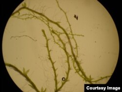 A close-up of the 1,500 old moss frozen in Antarctic permafrost that regenerates. (Credit: Esme Roads)