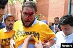 FILE - Juan Requesens, deputy of the Venezuelan coalition of opposition parties (MUD), is helped after being injured in clashes with pro-government supporters outside the offices of the Venezuela's ombudsman in Caracas, Venezuela, April 3, 2017.