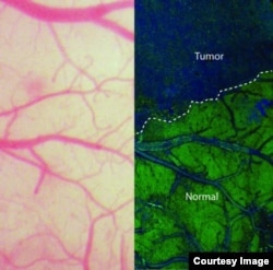 On the left, the view of the brain that neurosurgeons currently see during an operation using bright-field microscopy. On the right, an SRS microscopy view of the same area of brain - in this case, a mouse brain.