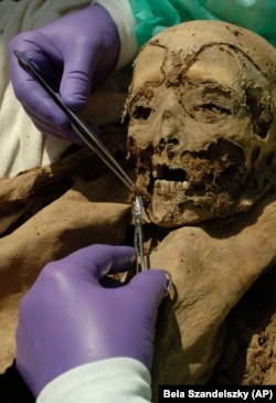 Hungarian mummies are helping scientists understand genetic mutations of colon cancer.