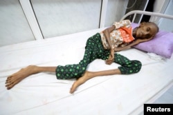 Saida Ahmad Baghili, 18, lies on a bed at the al-Thawra hospital where she receives treatment for severe malnutrition in the Red Sea port city of Hodeidah, Yemen, Oct. 24, 2016.