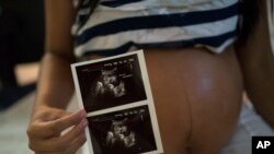 Isabela Cristina, 18, who is six months pregnant, shows a photo of her ultrasound at the IMIP hospital in Recife, Pernambuco state, Brazil, Feb. 3, 2016.