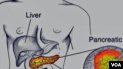 Para ilmuwan AS di Pusat Penelitian Kanker 'Fred Hutchinson' menemukan terobosan baru dalam pengobatan kanker pankreas.