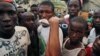 A man shows on his arm where he was injured at a rally in support of UFDG presidential candidate Cellou Dalein Diallo in Conakry, Guinea, Oct. 8, 2015.