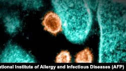 美国国家过敏症和传染病研究所提供的电子显微镜下的SARS-CoV-2病毒照片。（图片来源：AFP Photo/NIAID）