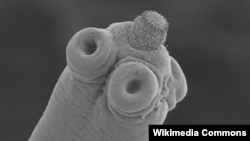 Tapeworm infections can be caused from eating infected, undercooked meat.